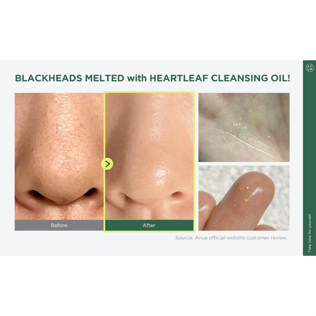 Anua - Heartleaf Pore Control Cleansing Oil - 200ml