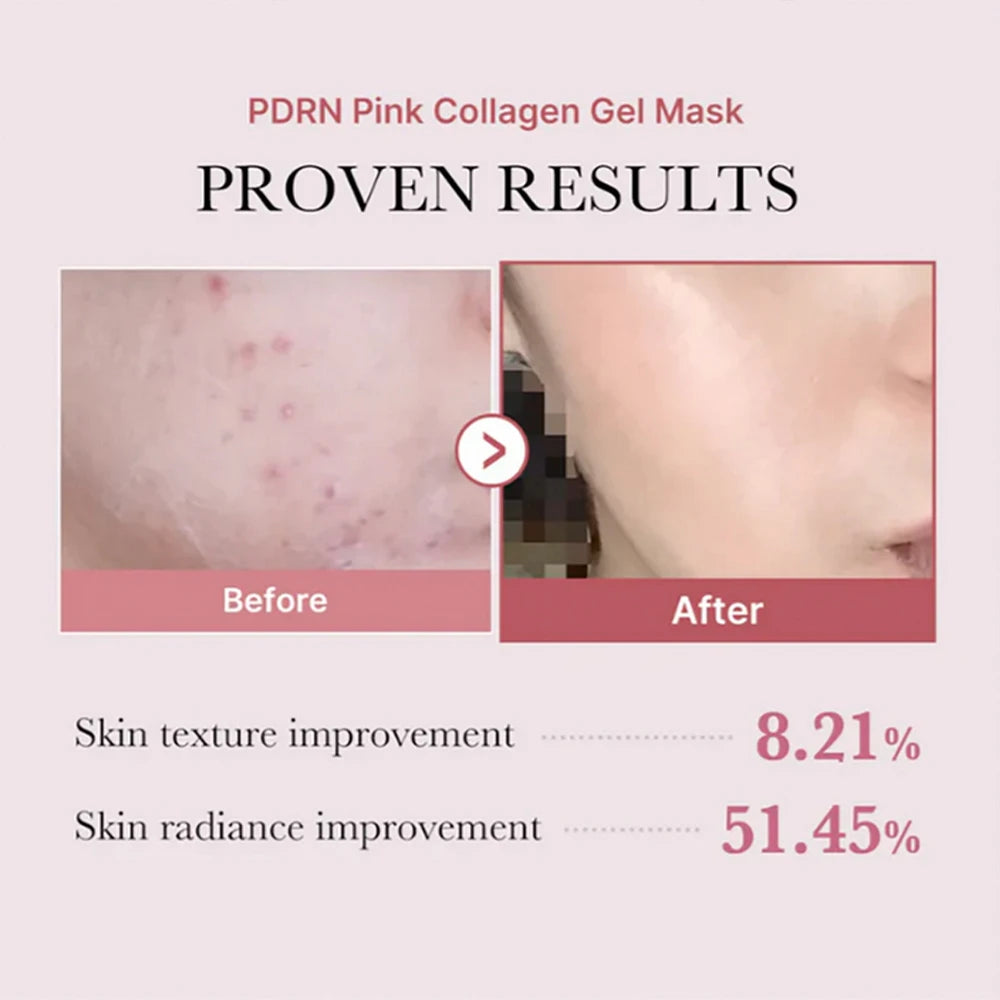 medicube PDRN Pink Collagen Gel Mask Sheet 1 kpl